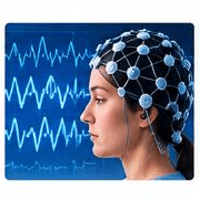 Electroencephalogram