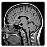 Magnetic resonance imaging