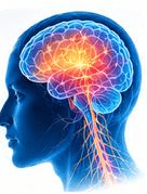 Epilepsy & Seizures